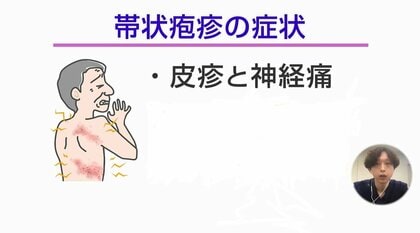 帯状疱疹は発症3日以内が肝心！失明や顔面神経マヒの恐れも…ワクチンで予防可能 症状や後遺症を専門医が解説