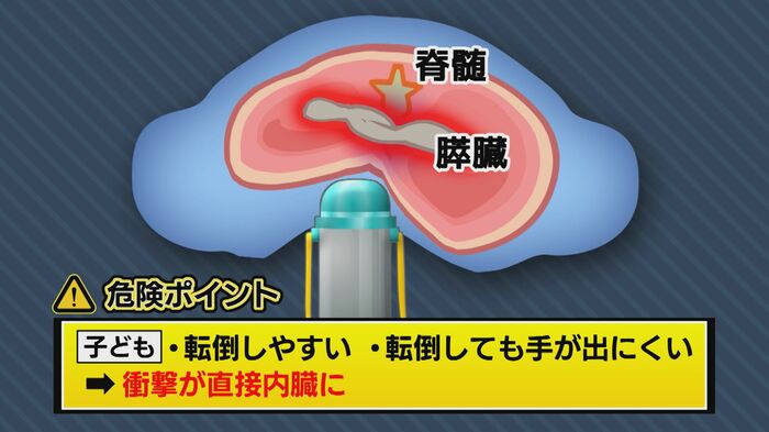 転倒した際に水筒で腹部を強く打つ事故が約40年間で14件以上発生