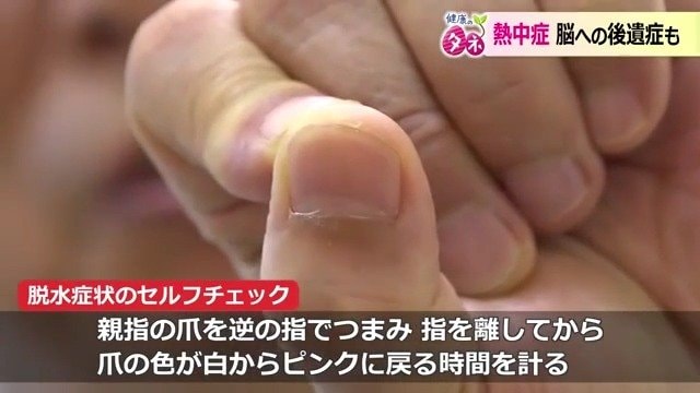 脱水を知るための簡単なセルフチェック方法