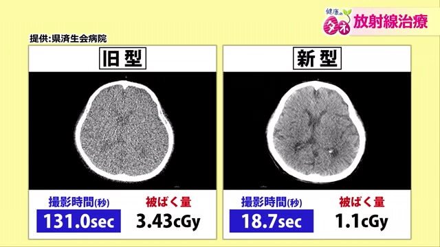 がん患部を撮影した画像が以前より鮮明に