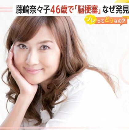 藤崎奈々子46歳で「脳梗塞」公表…「めまい以外症状なし」　若い年齢で発症することも…脳梗塞かもしれない“10のチェックリスト”