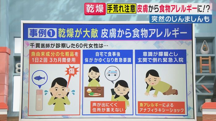 魚由来成分が引き金に（関西テレビ「旬感LIVE とれたてっ！」より）