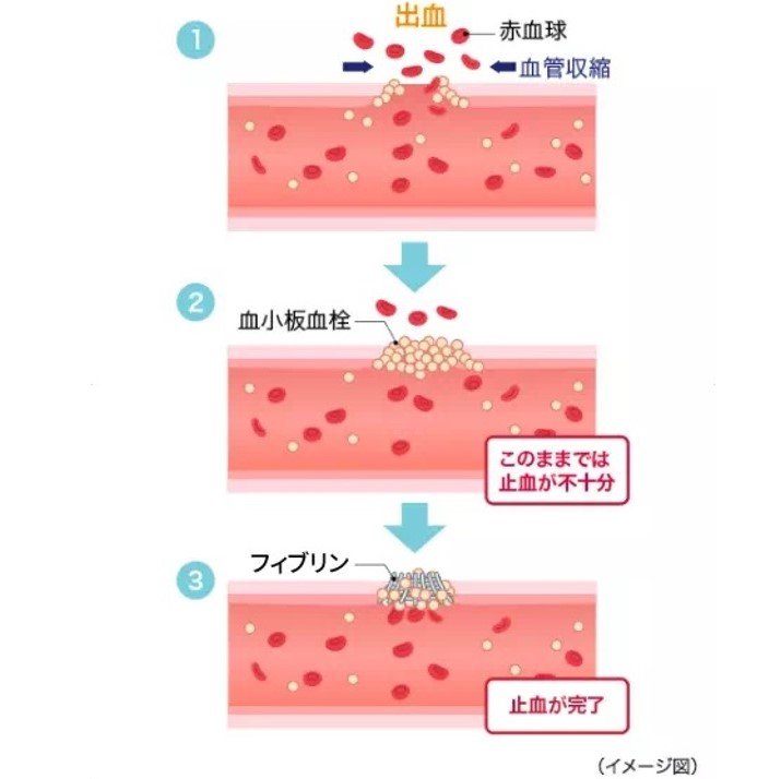 止血するしくみのイメージ図