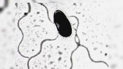 【夏の食中毒ココに注意！】夏本番の暑さが続く予想―暑さと共に増えてくる食中毒にも注意が必要 !「夏の食中毒対策」とは