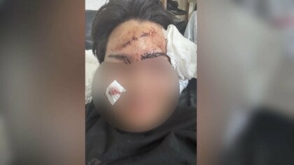 【独自】榊原容疑者に酒瓶で殴られ20針…被害者告白　元交際相手も語る“凶暴性”「親もペットも全部殺す」・ピアノ教師殺害