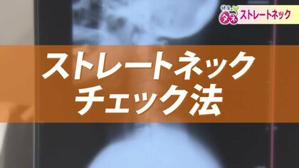 20歳以上の40％とも…現代病「ストレートネック」　スマホやパソコンの使い過ぎで首や頭に痛み…メカニズムや予防法を専門医が解説