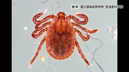 マダニによる「重症熱性血小板減少症候群」（SFTS）　関西在住の60代男性に陽性を確認　現在も入院中　長野市内の医療機関から届出　長野県内で初　県外で感染か