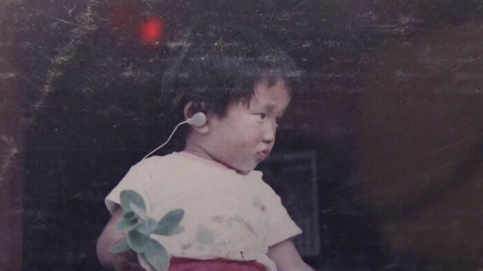 補聴器をつけるイラストレーター・中村一夫さんの幼少期の写真