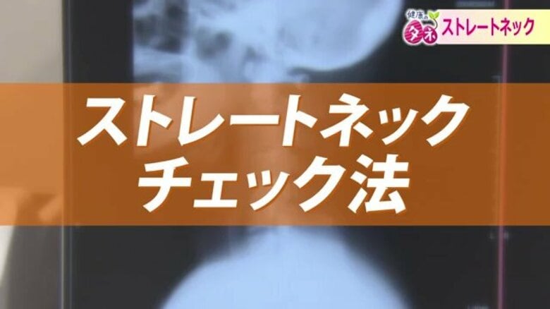 20歳以上の40％とも…現代病「ストレートネック」　スマホやパソコンの使い過ぎで首や頭に痛み…メカニズムや予防法を専門医が解説｜FNNプライムオンライン