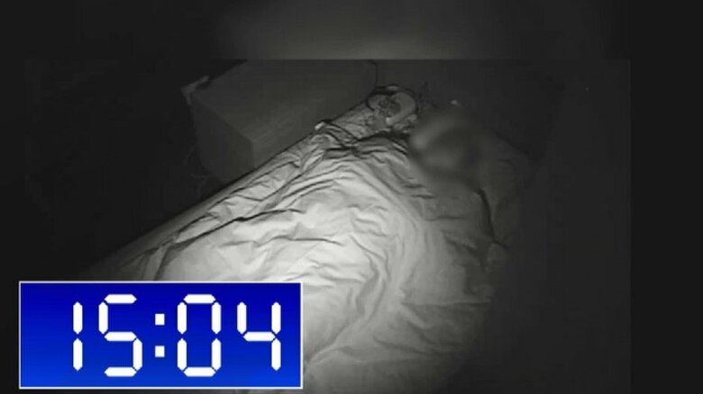 「睡眠時無呼吸症候群」　肥満だけでない…痩せ型の人も注意　“顎が小さいと気道が狭くなる”　心筋梗塞や脳梗塞リスクも｜FNNプライムオンライン