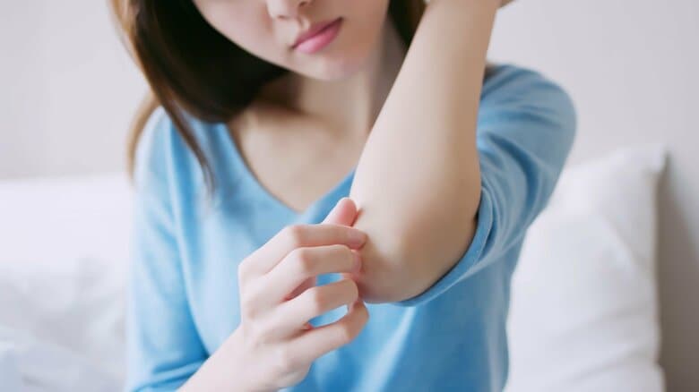 乾癬は皮膚の病気じゃない？人にうつらない…？「世界乾癬デー」に知る病気の正しい理解と偏見をなくす取り組み｜FNNプライムオンライン