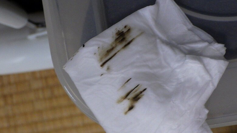 トコジラミの糞による茶色いシミ（画像提供：足立雅也さん）