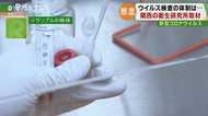 “新型コロナ”感染確定する「PCR検査」 管理体制や結果が出るまでにかかる時間は?