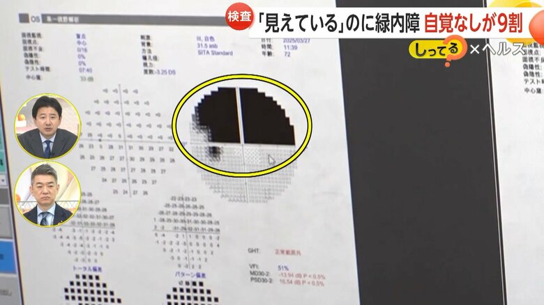 上半分の視野が欠けていると女性の検査結果